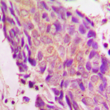 IKB epsilon Antibody