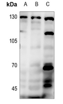 PRKD1/2/3 (pS738/S742) Antibody
