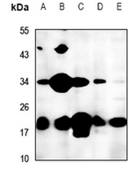FTH1 Antibody