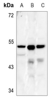 CLN5 Antibody