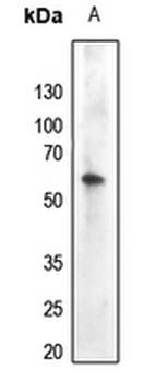 AKT (pY474) Antibody