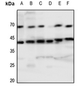 Tachykinin Receptor 1 Antibody