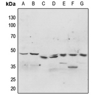 p47 phox (pS304) Antibody