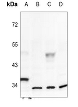 Inhibin alpha Antibody