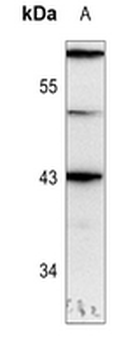GATA1 (pS310) Antibody