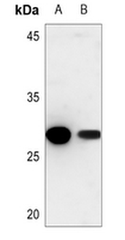 Cathepsin Z Antibody