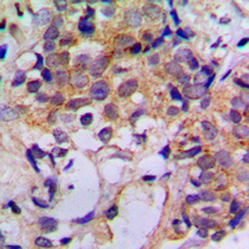 Cathepsin Z Antibody