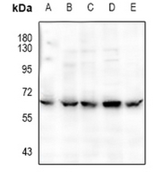 CaMK2 alpha/delta (pT286) Antibody