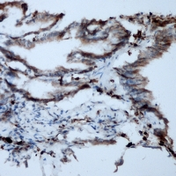 Collagen 1 alpha 1 Antibody