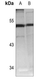 Cathepsin A 20k Antibody