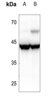 ANKRD1 Antibody