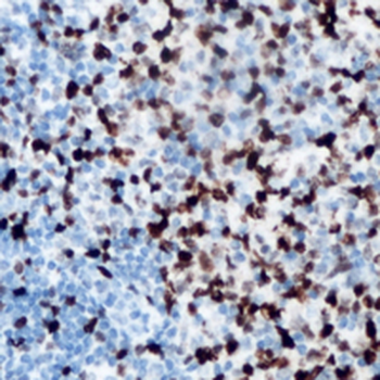 ANKRD1 Antibody
