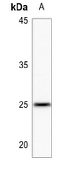 LYPLA1 Antibody