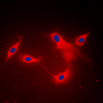 LYPLA1 Antibody