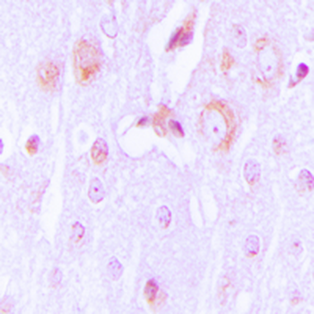 Tyrosine Hydroxylase Antibody