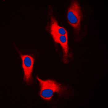 Tyrosine Hydroxylase Antibody