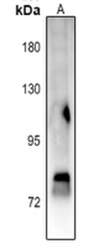 STAT4 (pY693) Antibody
