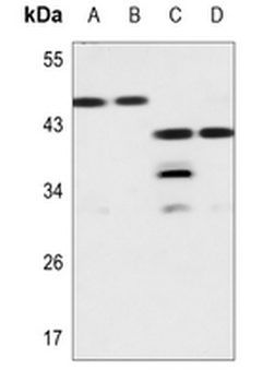 Galectin 8 Antibody