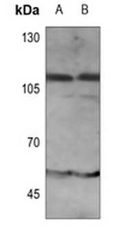 IFNAR1 (pY466) Antibody