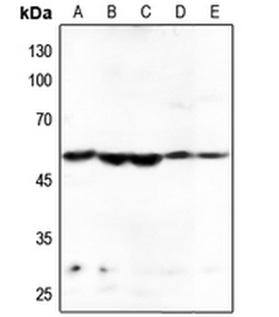 HARS Antibody