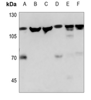 NAA15 Antibody