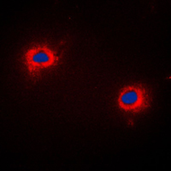 NIP1 Antibody