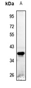 STEAP1 Antibody