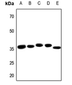 PRPF18 Antibody