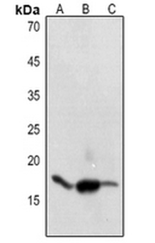 Histone H3 (AcK9) Antibody