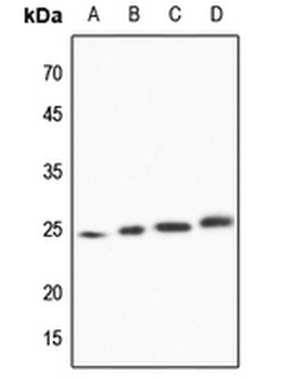 TCTP Antibody