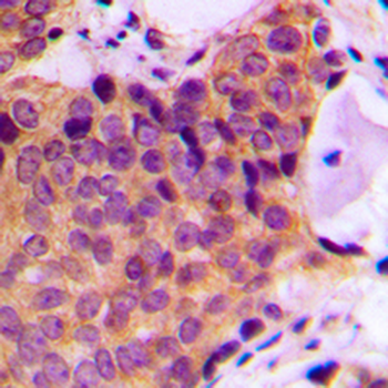 JNK1/2/3 (pT183) Antibody