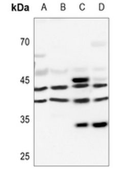 PRKAR1A Antibody