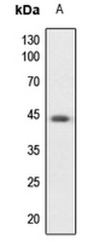 PKA C alpha/beta/gamma Antibody