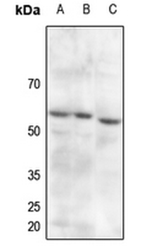 PDPK1 (pS241) Antibody