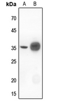IKB alpha Antibody