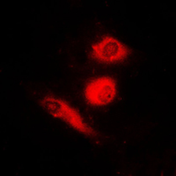 FOXO4 (pS197) Antibody