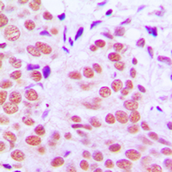 c-Jun (pT91) Antibody