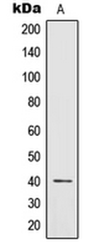 IL-12B Antibody