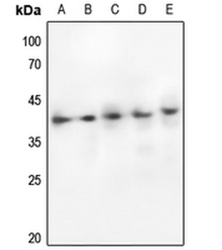 GSK3 alpha/beta Antibody