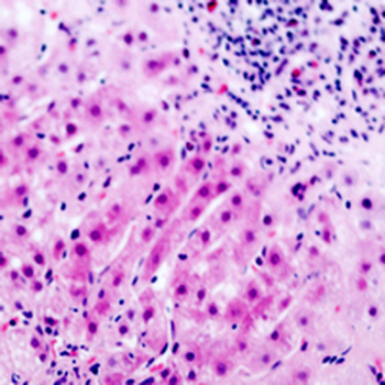 GDF9 Antibody