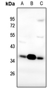 FR alpha Antibody