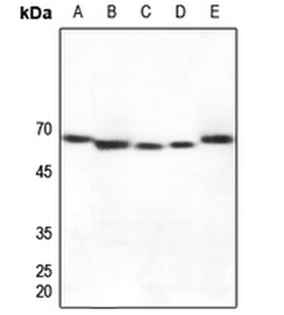 Cytochrome P450 27A1 Antibody