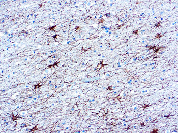 GLIAL FIBRILLARY ACIDIC PROTEIN (GFAP) Antibody