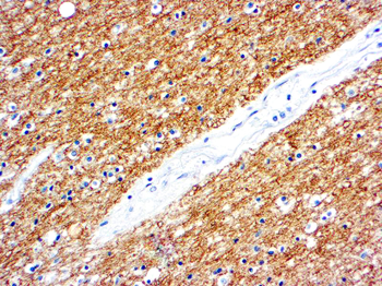 MYELIN BASIC PROTEIN Antibody