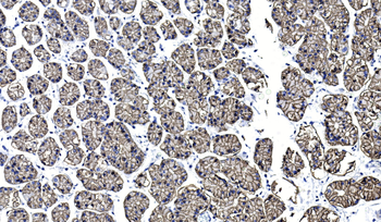 Claudin18.2 Antibody