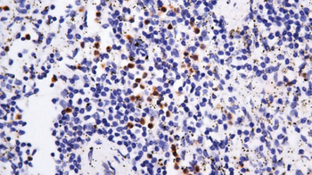 Granzyme B Antibody