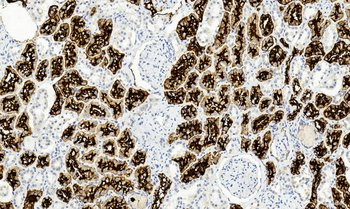 ACE2 Antibody