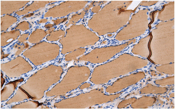 THY Antibody