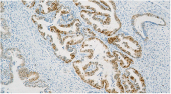 Pax-2 Antibody