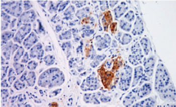 NSE Antibody